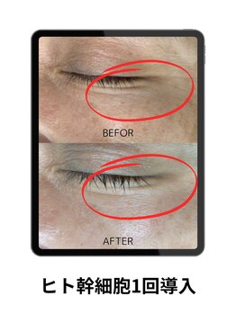 コンバートビューティーオタイ(ConBert Beauty otai)/シワ緩和・トーンUP