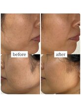 フェリス(FELIZ)/ホームケアで目指せ【魅せる肌】