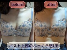 スノードロップ(snowdrop)/バストケア