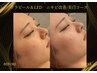 【鎮静＆美白LED×ララピール】ニキビ改善★韓国肌管理コース￥11,000