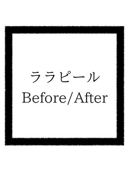 クリアボックス(Clear box)/【ララピール】