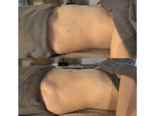 ピノ(pino)の雰囲気(しっかり結果が出るHOT腸もみ×全身深部リンパマッサージ)