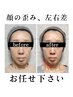 【再来女性★左右差/歪み/鼻筋改善】小顔頭蓋骨矯正+リンパケア ¥9,000→