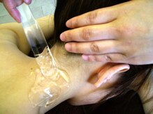 エルブランシェ(ELLE BRANCHE)/◆美肌脱毛◆うなじ