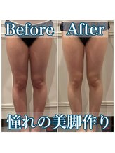 心斎橋 ルヴィ(REVI)/ハイパーナイフ