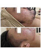 ルルボーテ(Loulou Beaute)/waxxxx＋VOSサロンケア