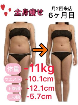 アフリオーラ はなみずき店(affriolant)/ビフォーアフター
