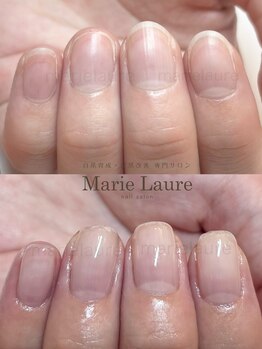 マリーロール 淀屋橋本店(Marie Laure)/自爪育成/深爪矯正/ネイルケア