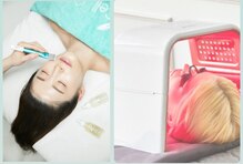 シャンディ(Shandy)