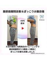 和ぎ整体院/腹直筋離開改善