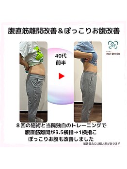 和ぎ整体院/腹直筋離開改善