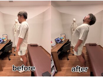 オン鍼灸整体院(ON鍼灸整体院)/整体&鍼灸/劇的ビフォーアフター