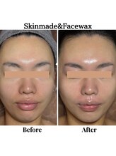 ラ ジェム(La gemme)/【スキンメイド】