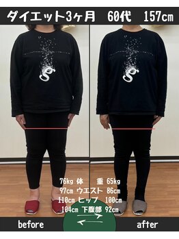 恵整骨院/60代 1ヵ月ダイエット成果