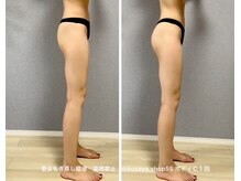 ウルル エルア(ululu 'elua)/ボディC1回