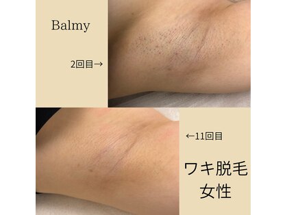 バルミー(Balmy)の写真