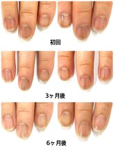 ブリエネイル/最強ネイルケア