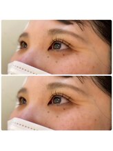 ジョリー(Jolie)/