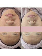 エヌ ドット ジュウイチ(N.11)/ビフォーアフター