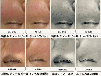 フェリス(FELIZ)/疲れたお肌にビタミンチャージ！