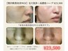 【贅沢肌質改善90分】毛穴洗浄＋高濃度ハーブ ¥23,500