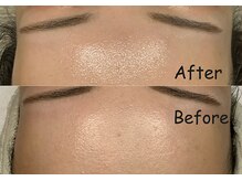 夏秋美肌サロン/ハーブ×セラピール