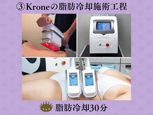 クローネ(Krone)/脂肪冷却20分