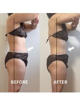 ブルーム(BLOOM)/痩身エステ1回