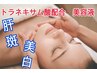 【シミ・くすみ】美白フェイシャル+トラネキサム酸導入60分¥15400→