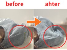 スッキリ整体院/巻き肩改善