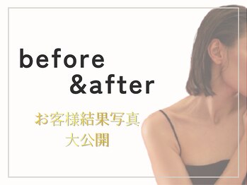 ジュリアン(Julien)/お客様結果写真 Before&After