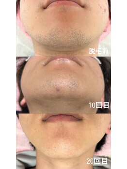 ミーフォレスト(Mi Forest)/