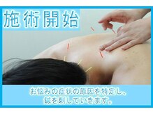 リケア鍼灸院 渋谷駅前(reCare)/施術開始