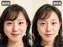 アオヤマ サロン ワイゼット(AOYAMA SALON YZ)