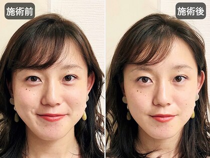アオヤマ サロン ワイゼット(AOYAMA SALON YZ)の写真