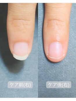 キラリネイル(KIRARINAIL)/お客さまの変化