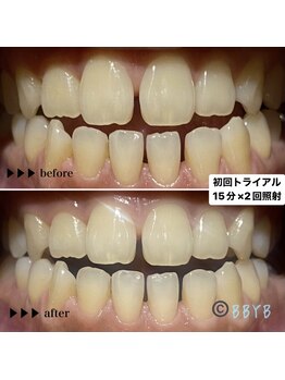 ビーバイビー(BBYB)/初回トライアルの実例♪