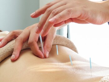 ぴっと鍼灸整体院/ポイント症状には鍼がオススメ