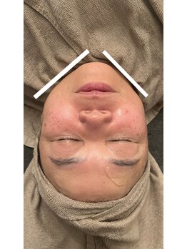 ベル(Belle)/EMSのbefore→after