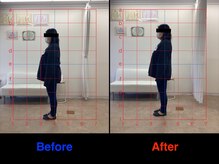 整体院 仁(JIN)/#産後骨盤#産後#マタニティ#腰痛