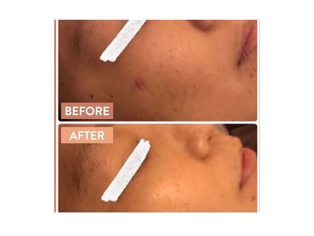 エステ ド あーと/ before/after