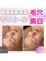 【回数券ご購入のお客様】毛穴・小顔・美白効果韓国最新美容!ララピール \0