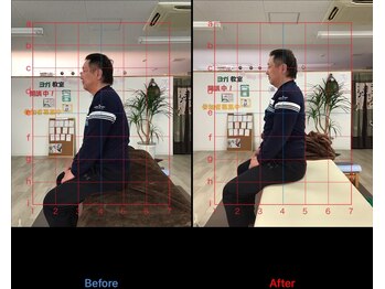 ストレチックス 近江八幡店/BeforeAfter