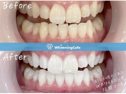 ホワイトニングカフェ 京橋店の写真