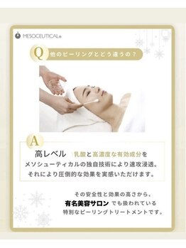 ココ 2号店(CoCo)/ホワイトスノーピール