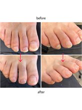 ケアプラス(care plus)/フットネイルケア