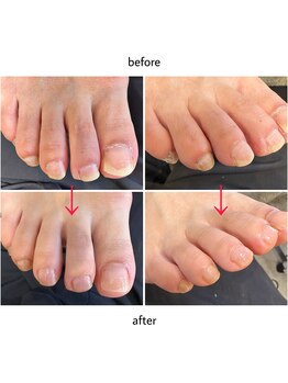 ケアプラス(care plus)/フットネイルケア