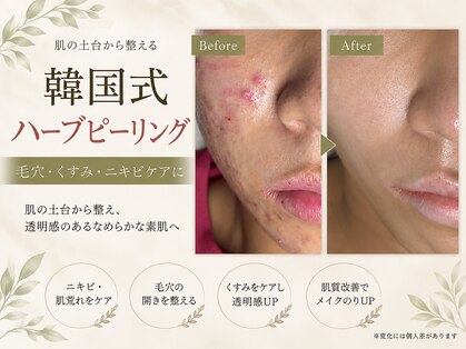 ソワラ 札幌の写真
