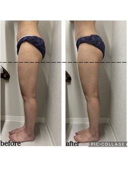 エンチャント(ENCHANT)/お尻の位置上がります！脚長効果