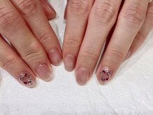 ブレスネイル(brace Nail)/